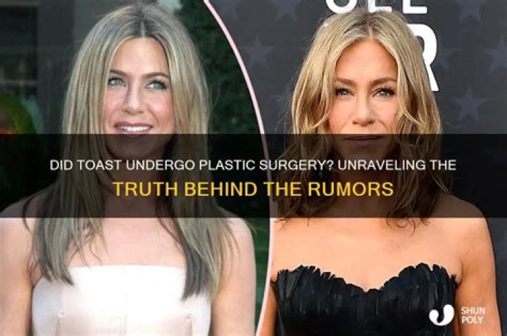 Unraveling The Truth Behind The Surgery Rumors