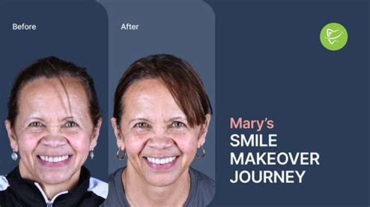 Unveiling Madison Keys' Dental Journey: A Smile Transformed